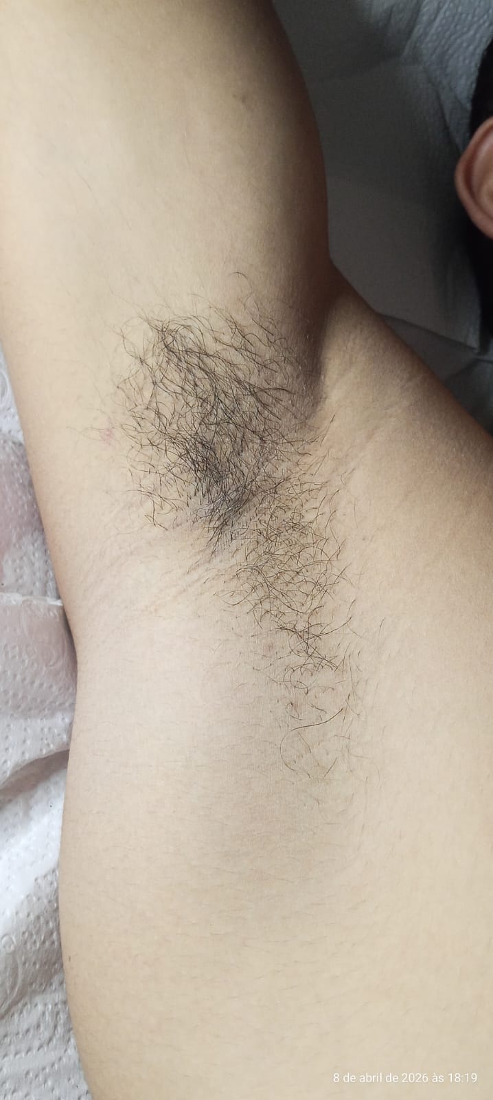 Antes 2